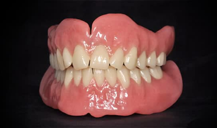 Nahaufnahme einer Zahnprothese mit Ober- und Unterkiefer