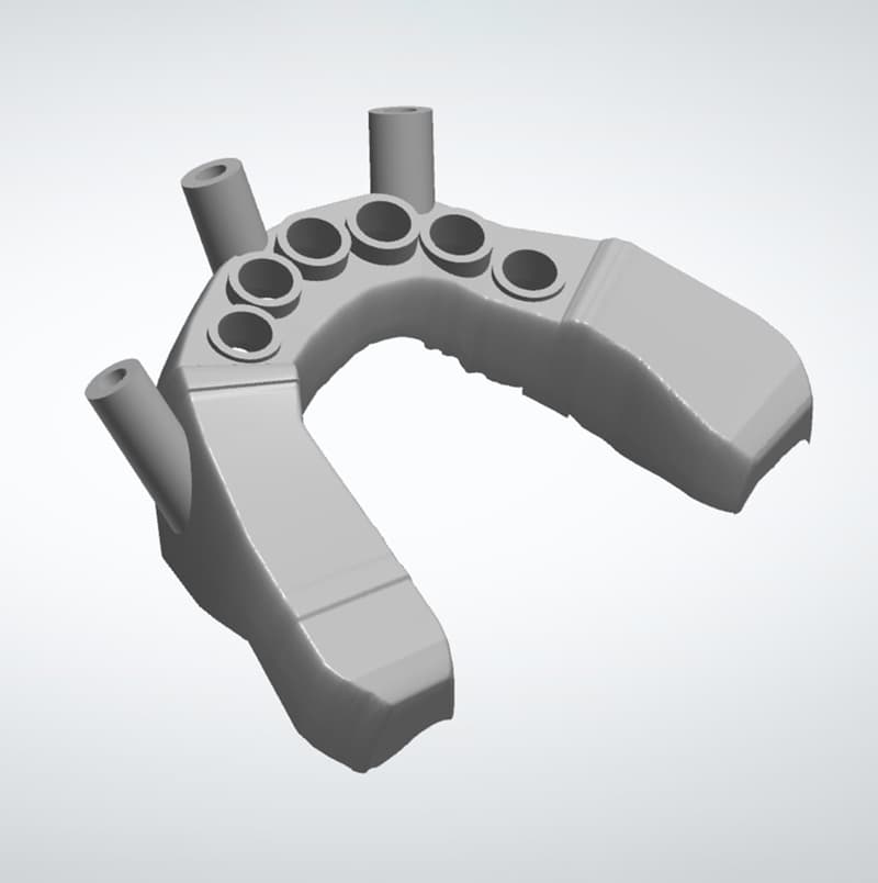 3D-Modell einer Bohrschablone für Implantate